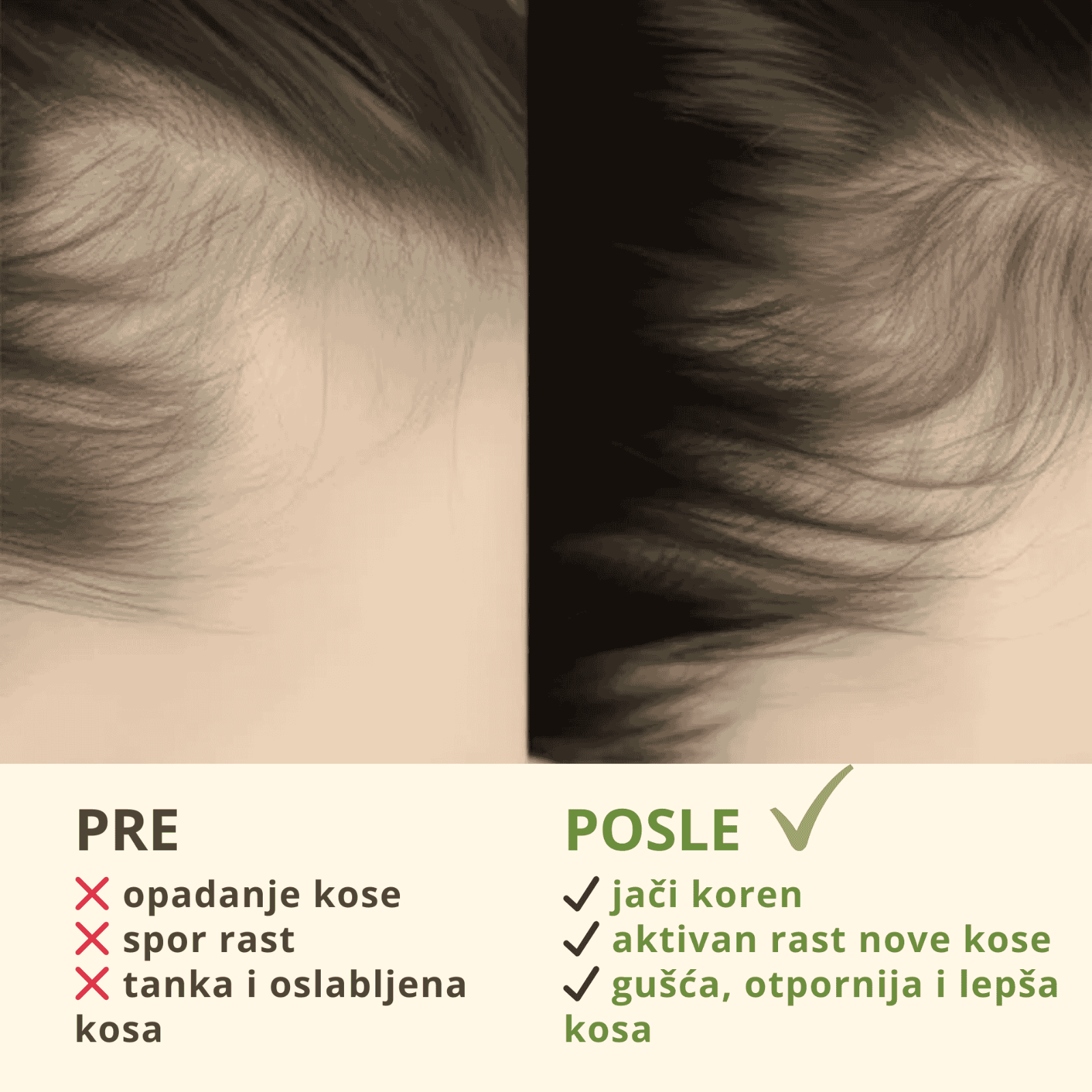 Hranljivi Serum Za Čvrstinu I Rast Kose